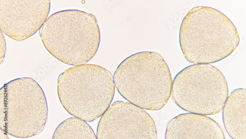Φωτογραφία Melon (Cucumis melo) pollen grains under light microscope
