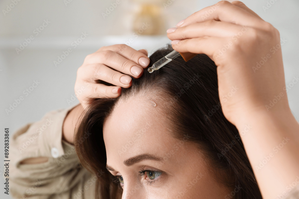Hair loss problem. Woman applying serum onto hairline indoors, closeup Hair loss problem. Woman applying serum onto hairline indoors, closeup