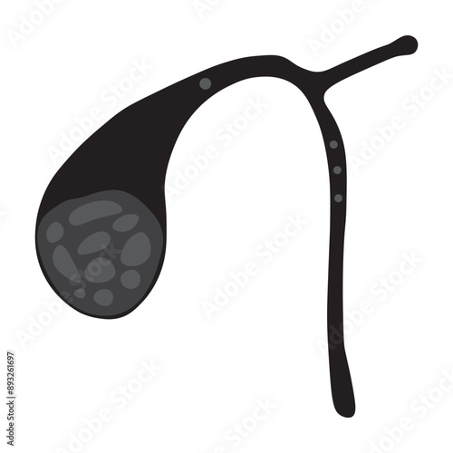 gallstones glyph icon 