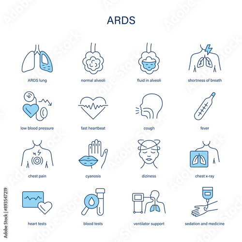 ARDS, Acute Respiratory Distress Syndrome symptoms, diagnostic and treatment vector icons. Medical icons.
