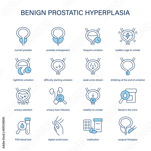 Benign Prostatic Hyperplasia symptoms, diagnostic and treatment vector icons. Medical icons.