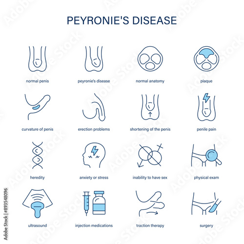 Peyronie's Disease symptoms, diagnostic and treatment vector icons. Medical icons.