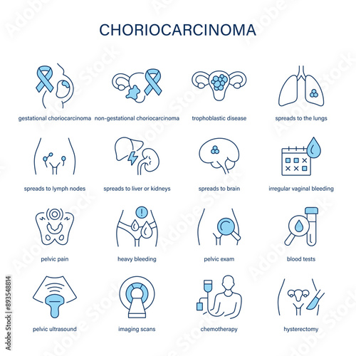 Choriocarcinoma symptoms, diagnostic and treatment vector icons. Medical icons.