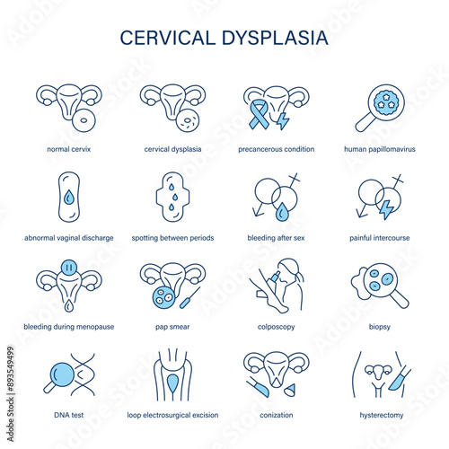 Cervical Dysplasia symptoms, diagnostic and treatment vector icons. Medical icons.