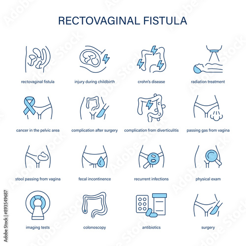 Rectovaginal Fistula symptoms, diagnostic and treatment vector icons. Medical icons.