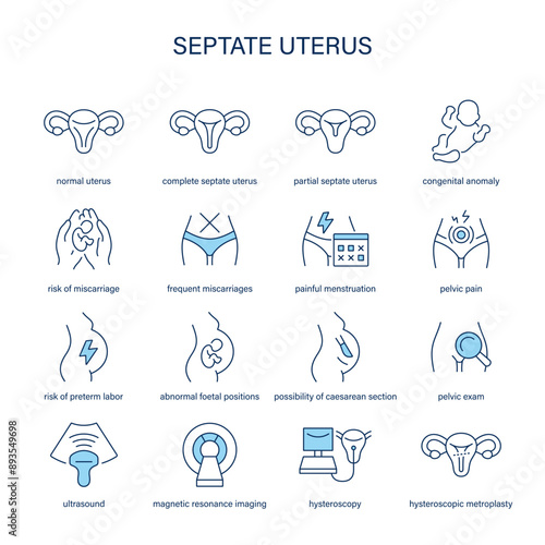Septate Uterus symptoms, diagnostic and treatment vector icons. Medical icons.