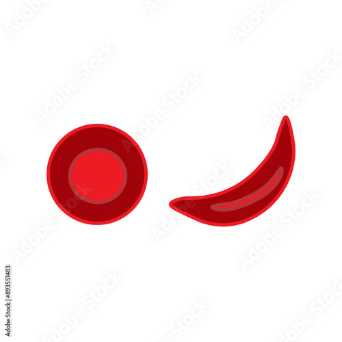 sickle blood cell and normal blood 