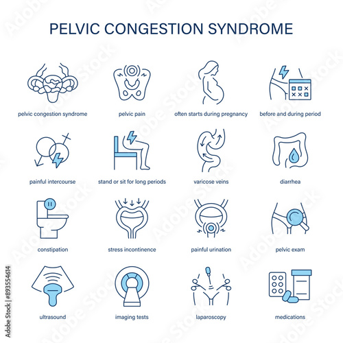 Pelvic Congestion Syndrome symptoms, diagnostic and treatment vector icons. Medical icons.
