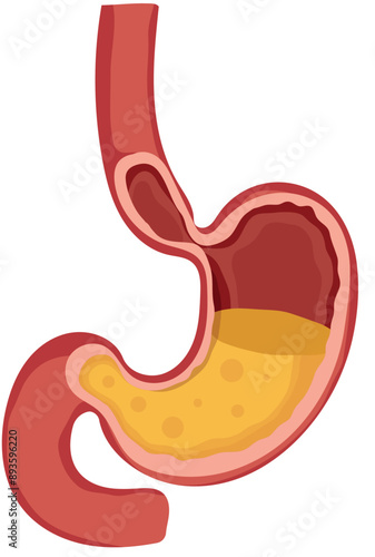 Human Stomach with Gastric Acid Liquid Illustration