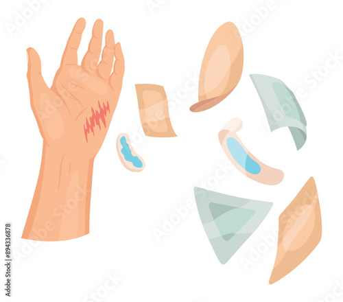 Hand injured skin and procedures of bandaging and wound cleaning. First aid for wound. Medicine cure or treatment. First emergency help for human hand trauma
