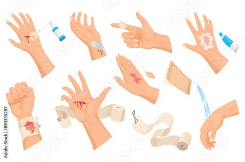 Hands injured skin and procedures of bandaging and wound cleaning. First aid for wound. Medicine cure or treatment. First emergency help for human hand trauma