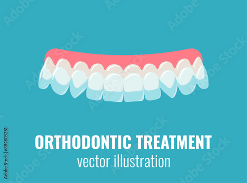 Invisible dental aligners. Orthodontic treatment, dental care