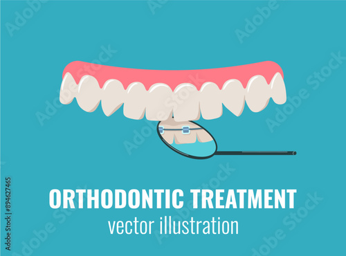 Invisible braces. Orthodontic treatment, dental care