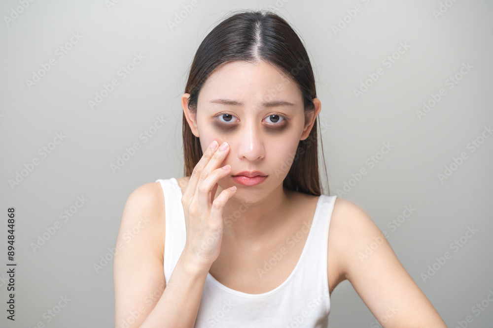 Bored, insomnia asian young woman, girl looking at camera, hand touching under eyes with problem of black circles or panda puffy, swollen and wrinkle on face. Sleepless, sleepy healthcare person. Bored, insomnia asian young woman, girl looking at camera, hand touching under eyes with problem of black circles or panda puffy, swollen and wrinkle on face. Sleepless, sleepy healthcare person.