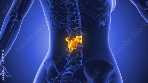 Quadro em tela Discomfort in the lumbar region