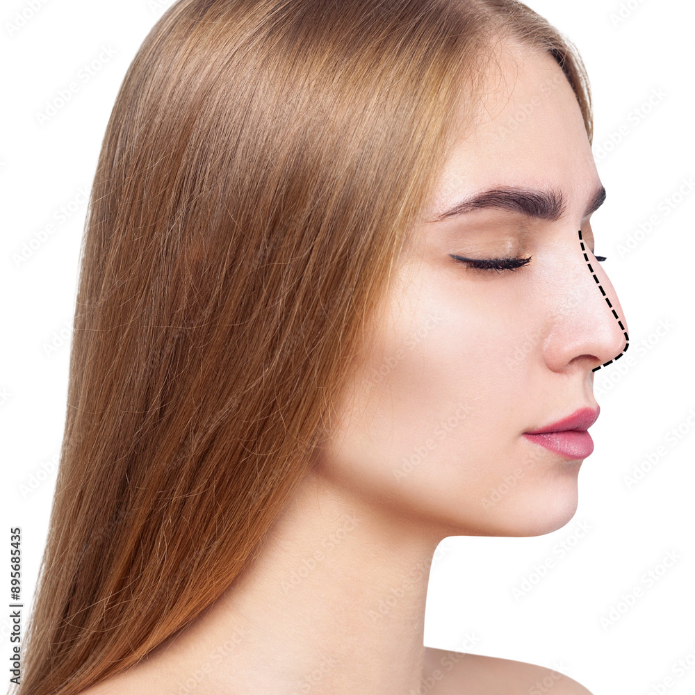 Woman before and after nose plastic surgery. Woman before and after nose plastic surgery.