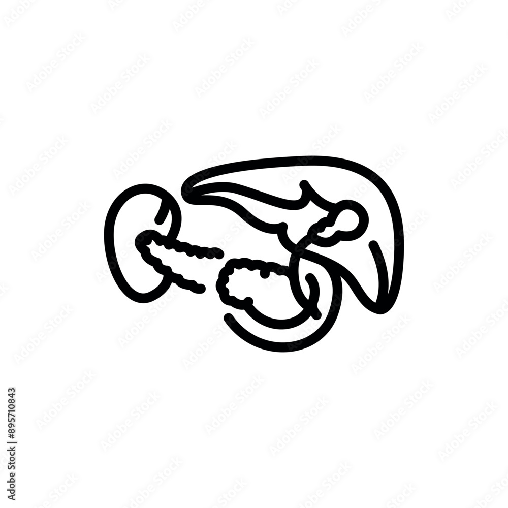 Pancreatectomy black line icon. Operations on the abdominal cavity. Pancreatectomy black line icon. Operations on the abdominal cavity.