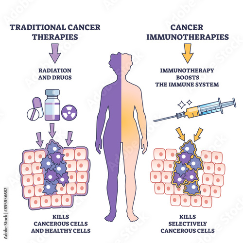 Immunotherapy method for cancer treatment for immune system outline diagram, transparent background. Labeled educational scheme as medical therapy for oncology illness illustration.