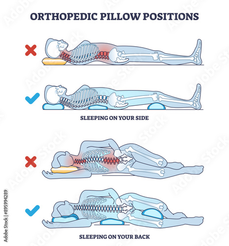 Orthopedic pillow positions with sleeping on side and back outline diagram, transparent background. Labeled educational poses with good, correct and healthy example comparison to wrong illustration.
