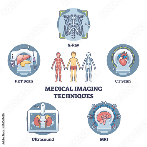 Medical imaging techniques for medical body diagnostics outline diagram, transparent background.Labeled educational scheme with types for bones or organs inner examination illustration.