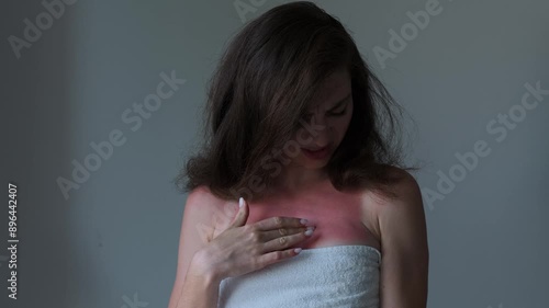 A woman with sunburned skin touching her chest, emphasizing the importance of self-care, sun protection, and sunburn relief