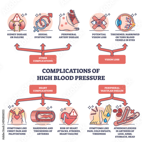 Complications of high blood pressure and possible diseases outline diagram, transparent background. Labeled educational scheme with potential vision loss, chest pain, heart attack.