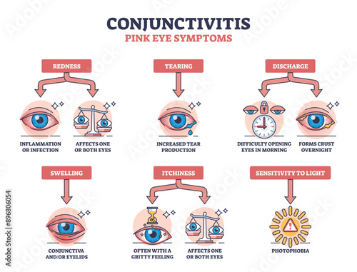 Conjunctivitis or pink eye symptoms with medical examples outline diagram, transparent background. Labeled educational scheme with affected redness, tearing, swelling.
