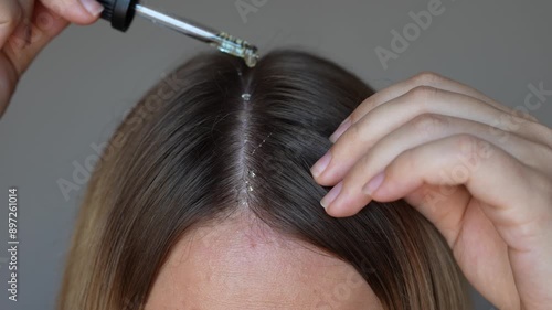 Young blonde woman applying essential cosmetic burdock oil with a dropper to the parting of the head with hands to strengthen, activate hair growth and reduce hair loss on a dark grey background photo