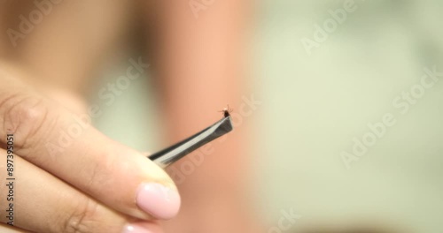 A close-up of a woman holds tweezers containing a live tick she removed it from her dog fur. Protecting pets from ticks in summer season. Taking care of your health. Drops and tablets against ticks.