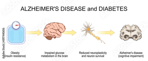 Diabetes and Alzheimers disease