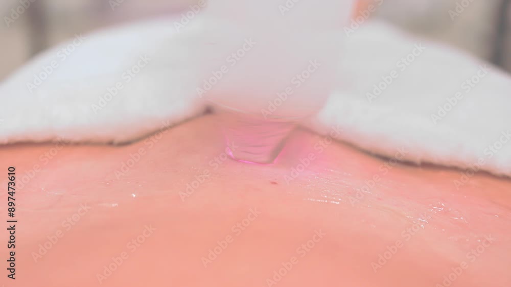 Laser hair removal in the salon. Laser hair removal in the salon.