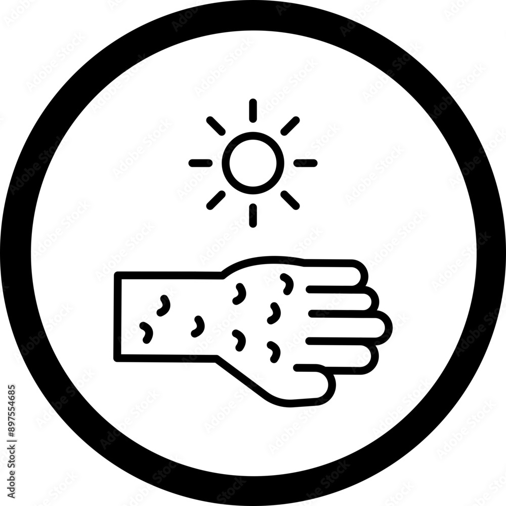 Fototapeta premium Sunburn Vector Icon Design