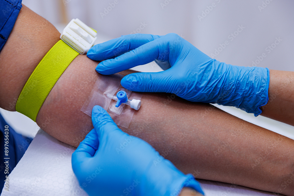 A patient with serum administered in the hospital. Serum is given to the patient. The serum that the nurse makes to her patient. While the doctor opens a vascular access to the patient. A patient with serum administered in the hospital. Serum is given to the patient. The serum that the nurse makes to her patient. While the doctor opens a vascular access to the patient.