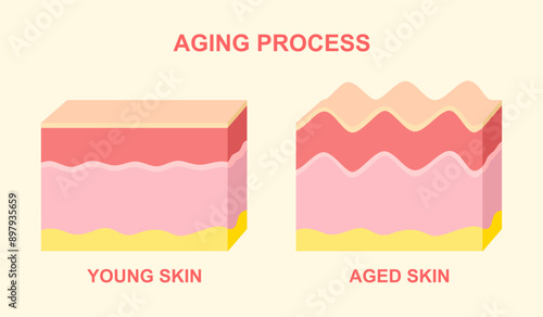 Aging process. comparison of young and aged skin. collagen, elastin and fibroblasts in younger and older skin. Age-related changes in the skin when collagen fibers atrophy, and elastin broken.