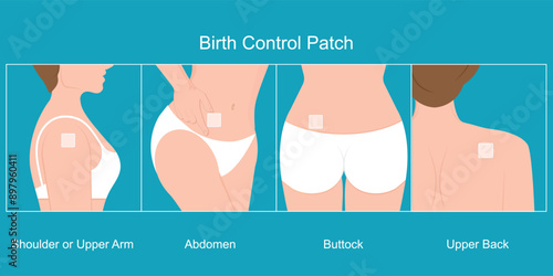 Birth Control Patch.