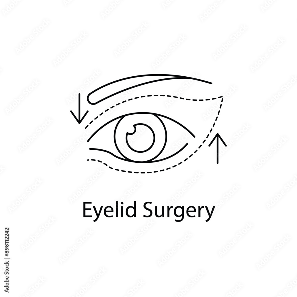 Eyelid Surgery, Blepharoplasty, Eye Lift, Cosmetic Surgery, Eyelid Lift, Eyelid Surgery Icon, Eyelid Surgery Vector, with editable stroke. Eyelid Surgery, Blepharoplasty, Eye Lift, Cosmetic Surgery, Eyelid Lift, Eyelid Surgery Icon, Eyelid Surgery Vector, with editable stroke.