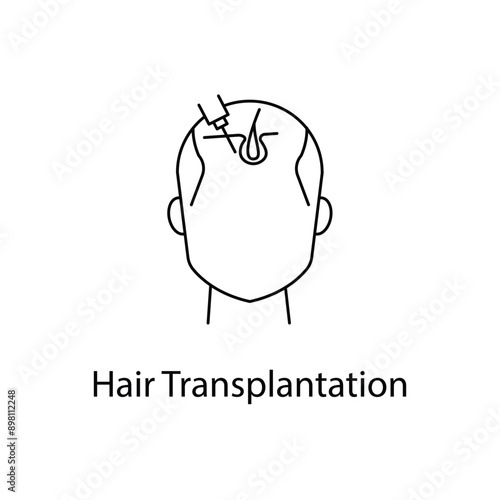  Hair Transplantation, Hair Restoration, Hair Surgery, Cosmetic Surgery, Hair Transplant Icon, Hair Transplant Vector, with editable stroke.