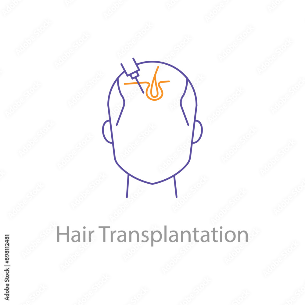 Fototapeta premium Hair Transplantation, Hair Restoration, Hair Surgery, Cosmetic Surgery, Hair Transplant Icon, Hair Transplant Vector, with editable stroke.