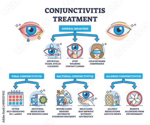 Conjunctivitis treatment with medicines and medical help outline diagram, transparent background. Labeled educational scheme with simple care recommendations for viral.
