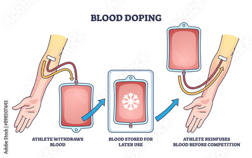 Blood doping principle with athlete reinfusion for strength and power outline diagram, transparent background. Labeled educational scheme.