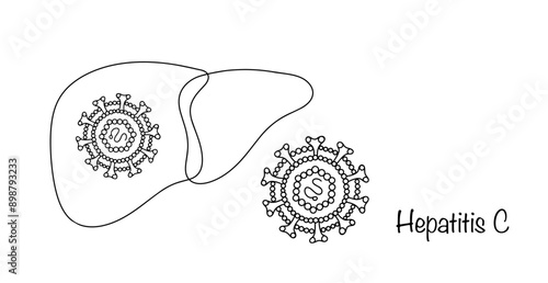 Hepatitis C