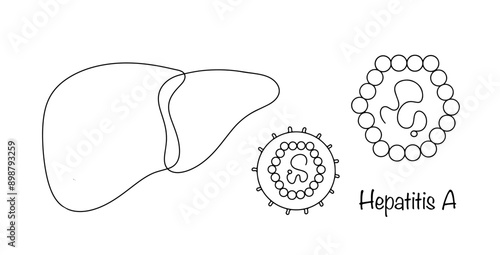 Hepatitis A