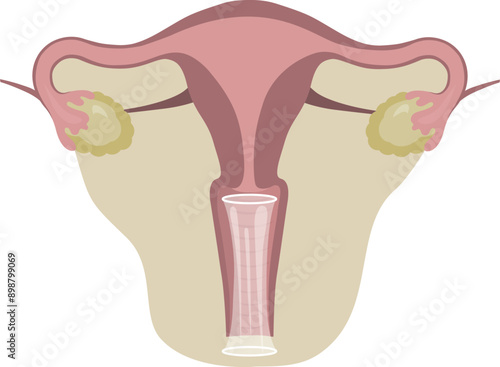 Vector illustration of a female condom.