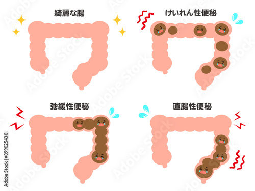 シンプルな大腸と便秘の図解イラスト素材セット2