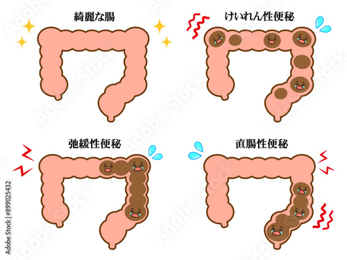 シンプルな大腸と便秘の図解イラスト素材セット