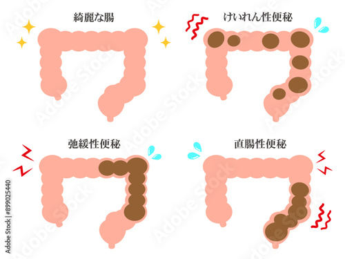 シンプルな大腸と便秘の図解イラスト素材セット3