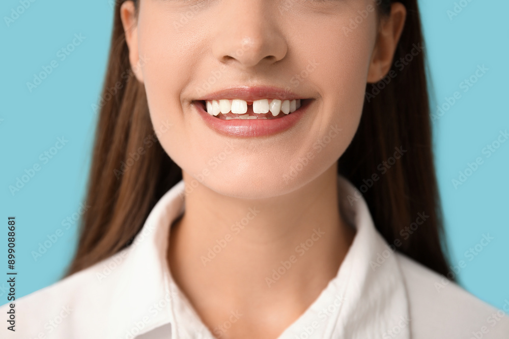 Young woman with diastema smiling on blue background, closeup Young woman with diastema smiling on blue background, closeup