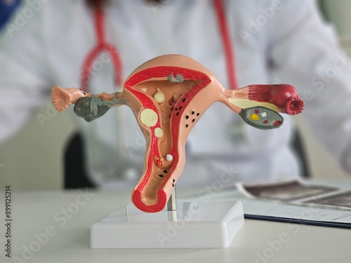 Anatomical model of the female reproductive system and ultrasound image photo