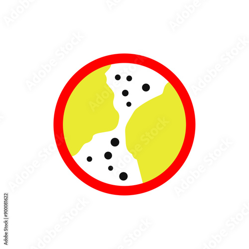 Stroke and Cholesterol Disease