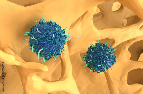 CAR T cell therapy in Osteoporosis - closeup view 3d illustration photo